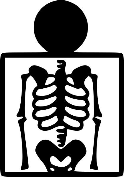 X Rays Png Transparent Image Download Size 420x597px