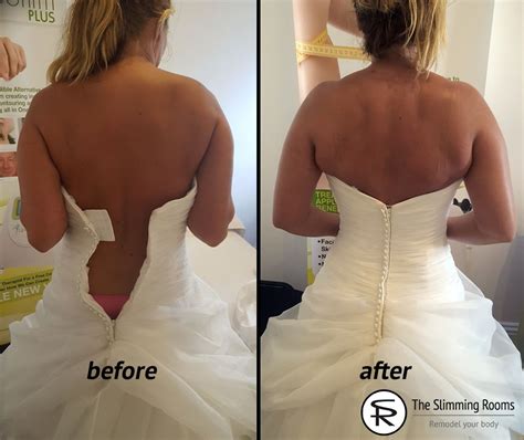 Vickys Wedding Weight Loss On The Express Body Package The Slimming