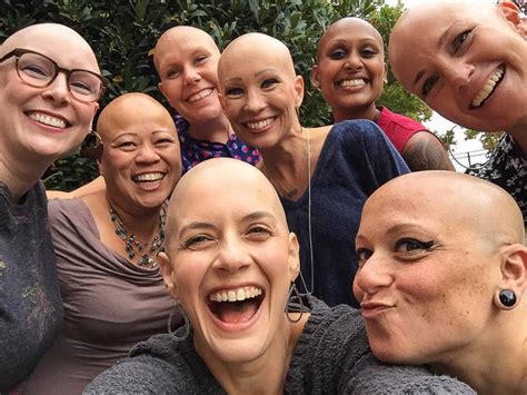 Bay Area Bald Girls Its Not Just Hair Kqed