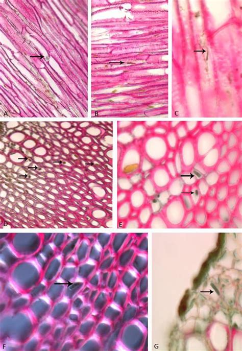 Transverse And Longitudinal Microtome Sections Obtained From Root And