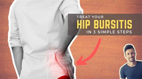 Successfully Treat Your Hip Bursitis In 3 Simple Steps Youtube
