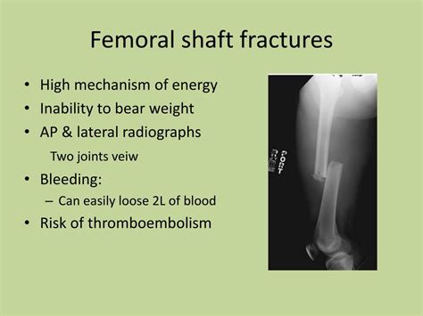 Ppt Common Lower Limb Fracture Powerpoint Presentation Free Download