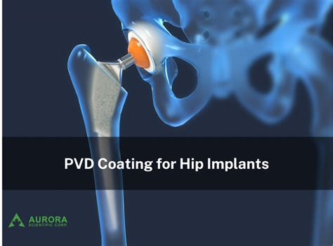 Pvd Coating For Hip Implants Aurora Scientific Corp