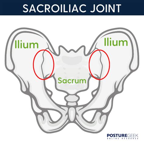 Sacroiliac Joint Pain What You Need To Know