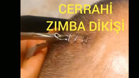 Zimba D K Sug Cal Staples Callstones Diki Nas L At L R Youtube