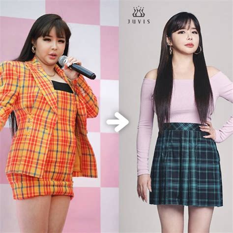 Fans Worried For Park Bom’s Health After Youtuber Posts Video ‘explaining Reason For Her Weight