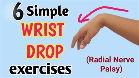 Wrist Drop Exercises In Hindi Radial Nerve Palsy Exercises Youtube
