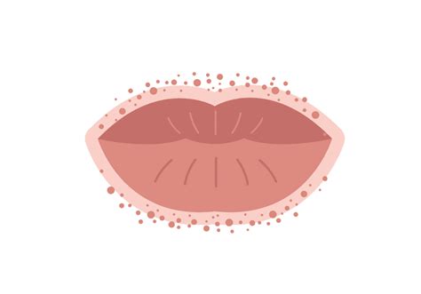 What Causes A Red Rash Around Your Lips Allergy Trigger