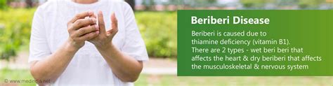 Beriberi Disease Frequently Asked Questions