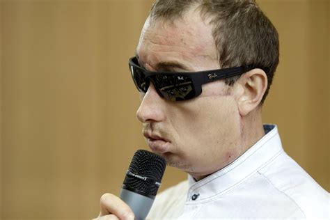 Polish Face Transplant Patient Leaves Hospital Photo 1 Pictures