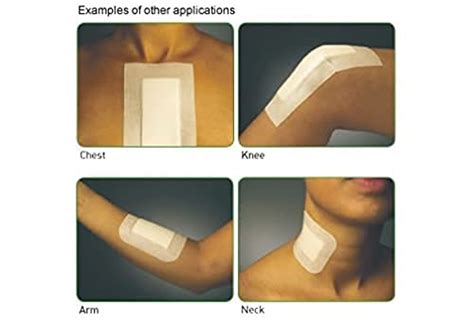 Large Adhesive Sterile Wound Dressings Pack Of 20 Suitable For