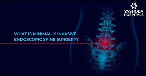 Minimally Invasive Endoscopic Spine Surgery Best Treatment For Spinal