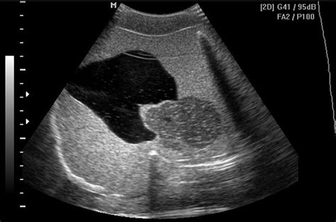 Multi-Modality Pelvic Phantom CIRS 048A realistic ...