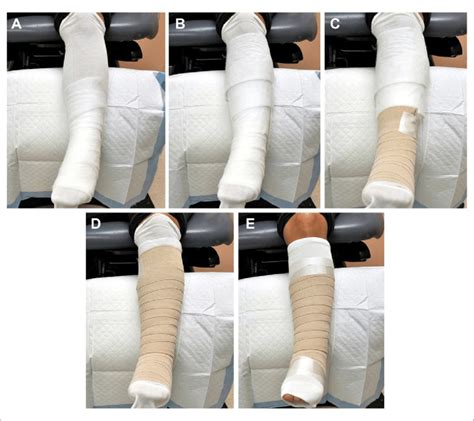 A Two Layers Of Multipurpose Underpadding Bandage Are Placed Over The