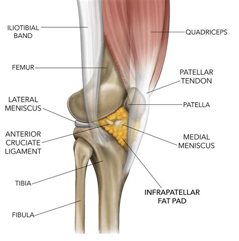 Hoffa S Syndrome Anterior Knee Pain Syndrome Fat Pad Impingement My Xxx Hot Girl
