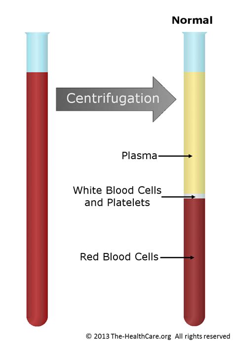 Low Red Blood Cells Understanding Anemia