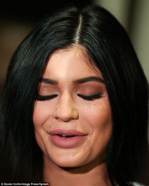 Kylie Jenner Displays Smooth Skin And A Plumped Up Pout As Celebrity