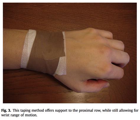 Two Ways To Tape The Wrist Rigid Tape And Kinesiology Tape