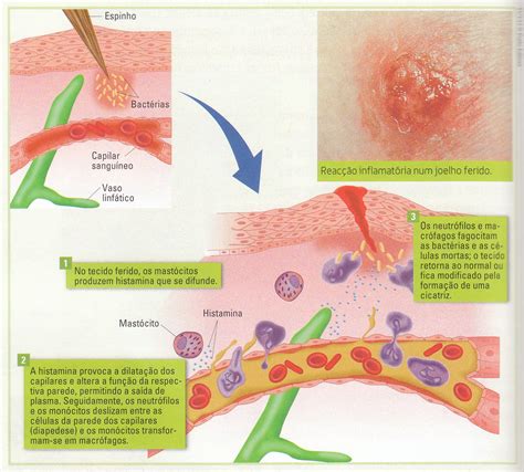 Toda Reacao Inflamatoria Possui Mediadores