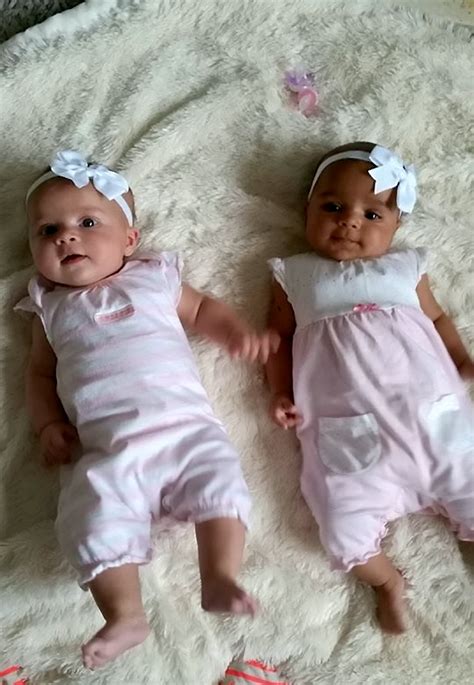 These Black And White Babies Are Twins But Nobody