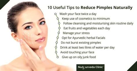 How To Get Rid Of Pimples 6 Tips To Remove Pimples Naturally