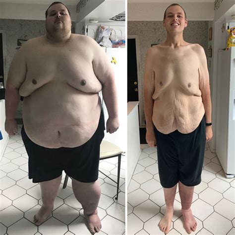 97 Times People Surprised Everyone By Losing So Much Weight They Looked Like A Different Person