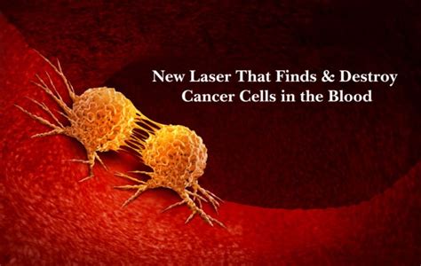 Using Laser Technology To Detect Cancer Cells The Silo