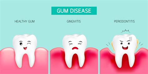Four Unexpected Consequences Of Untreated Gum Disease Dr Matt