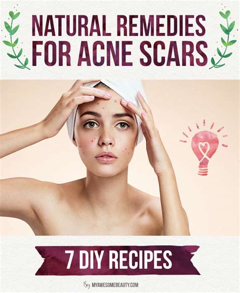 How To Get Rid Of Acne Scars Fast The 20 Best Treatments And Tips