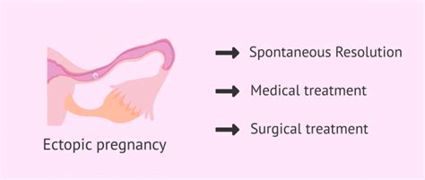 Treatment For Ectopic Pregnancy