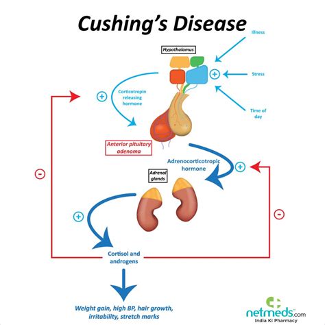 Cushing Syndrome Causes Symptoms And Treatment Netmeds