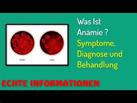 Was Ist An Mie Symptome Diagnose Und Behandlung Youtube