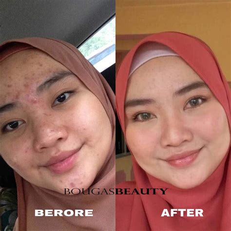 This product only uses natural ingredients based on plants and chemica развернуть. Apa Yang Bougas Beauty Serum Dah Buat Pada Kulit Muka Aku ...