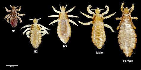 Epidemic And Murine Typhus Lice Fleas And Bacteria Hubpages