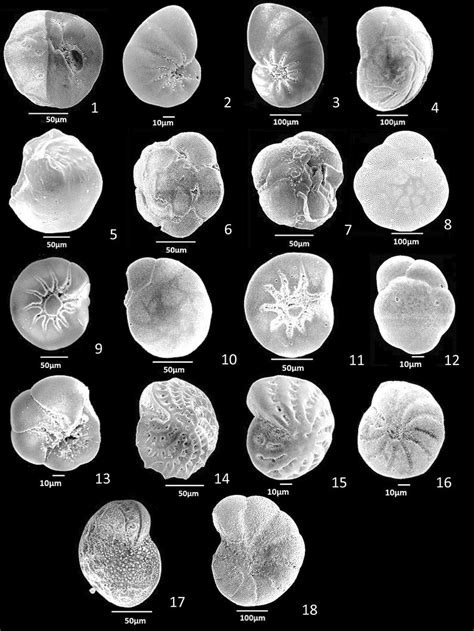 Sem Photomicrograph Of Some Selected Benthic Foraminifera 1