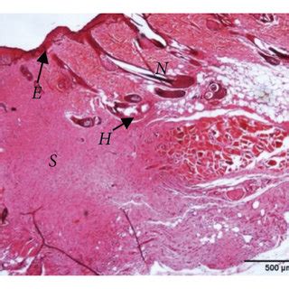 Hematoxylin Eosin H E Staining Of Granulation Healing Tissue Of