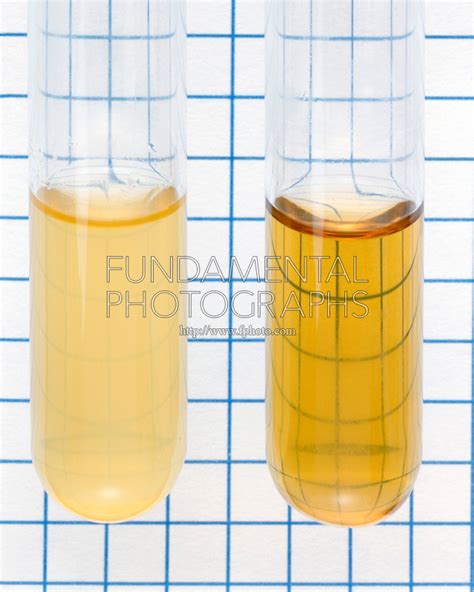 Turbidity Urine Comparison Specimen Sample Fundamental Photographs