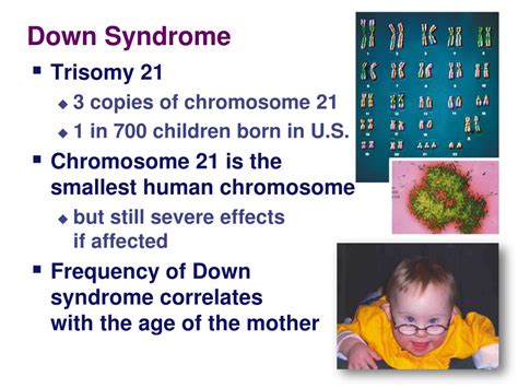 Ppt Chromosomal Abnormalities In Humans Powerpoint Presentation Free Download Id