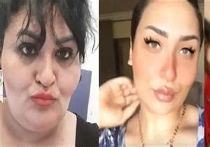 أصدرت المحكمة الاقتصادية، اليوم الأربعاء، حكمها على شريفة رفعت وشهرتها شيري هانم وابنتها زمردة بتهمة ممارسة الدعارة وعاقبتهما بالحبس 6 سنوات لكل منهما، وغرامة 100 ألف جنيه، ووضعهما تحت المراقبة الشرطية 3 سنوات. ممارسة-الدعارة | مصراوي