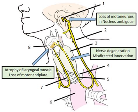 Genes Free Full Text Gene Therapy For Recurrent Laryngeal Nerve Injury