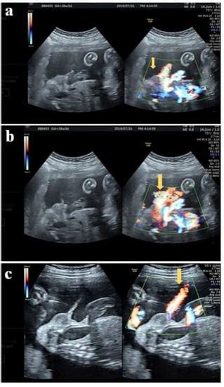 Diagnostics Free Full Text Ultrasonographic Diagnosis Of Fetal