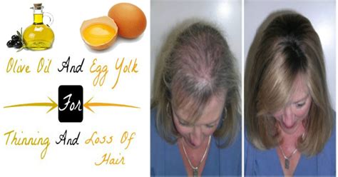 Below are two possible benefits that egg yolks could offer the hair. Olive Oil and Egg Yolk For Thinning and Loss Of Hair ...