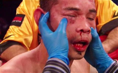 This is guillermo rigondeaux vs nonito donaire (gp highlights) by gorilla productions on vimeo, the home for high quality videos and the people who love… Rachel: Donaire had problems getting below the 130s in ...