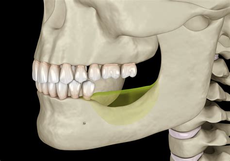 What Is Jaw Bone Resorption What Are The Symptoms Dentevim Dental