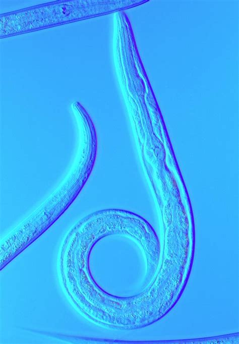 Lm Of The Nematode Worm Photograph By Sinclair Stammersscience Photo
