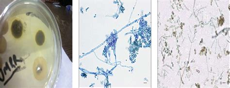 Définition conidiospore dans le dictionnaire de définitions reverso, synonymes, voir aussi 'conidiosporé',conidiosporé',conidiophore',conchospore', expressions, conjugaison, exemples. Microscopic structure of hyphae conidiophores and conidia ...