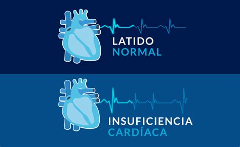 Enfermedades Cardiovasculares LATAM Cuidando tu corazón