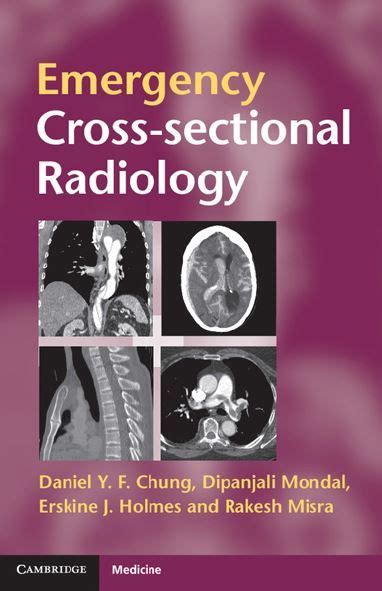 Emergency Cross Sectional Radiology Pdf Radiology Radiology Imaging