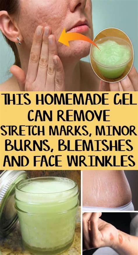 This Homemade Gel Can Remove Wrinkles Stretch Marks Blemishes And