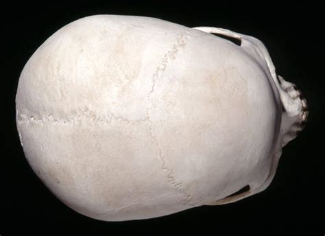 Top View Homo Sapiens Skull Australian Museum